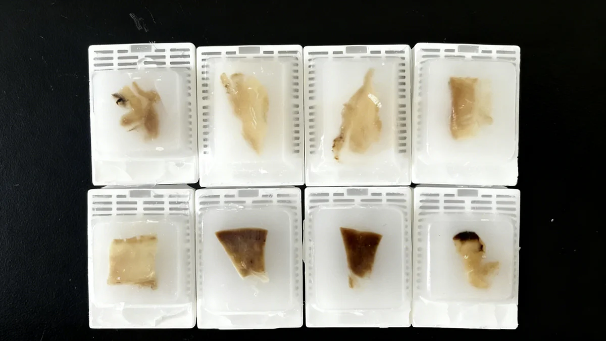 Consistent paraffin blocks produced by controlled tissue processing