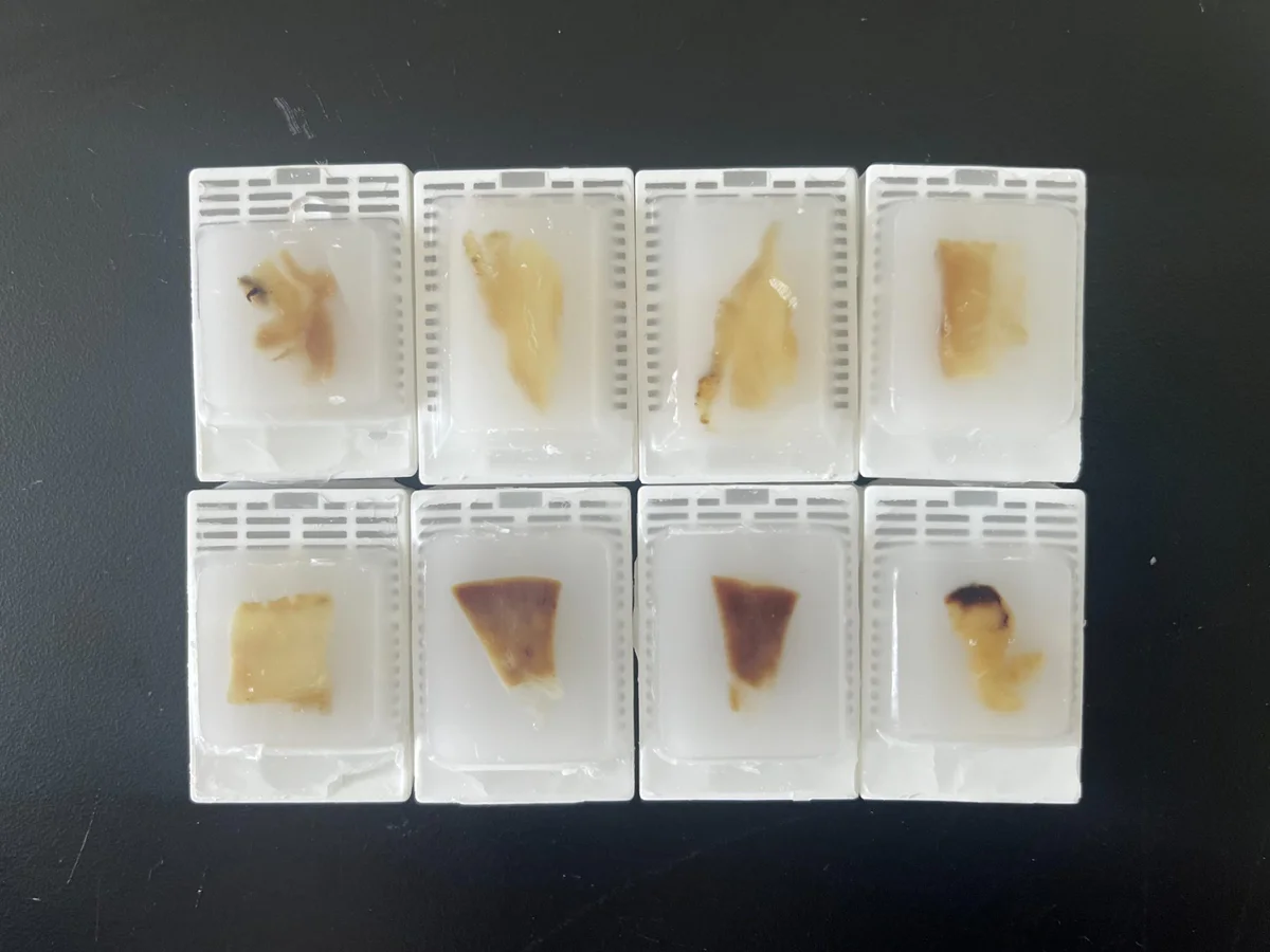 Processed paraffin blocks after dehydration, clearing and infiltration