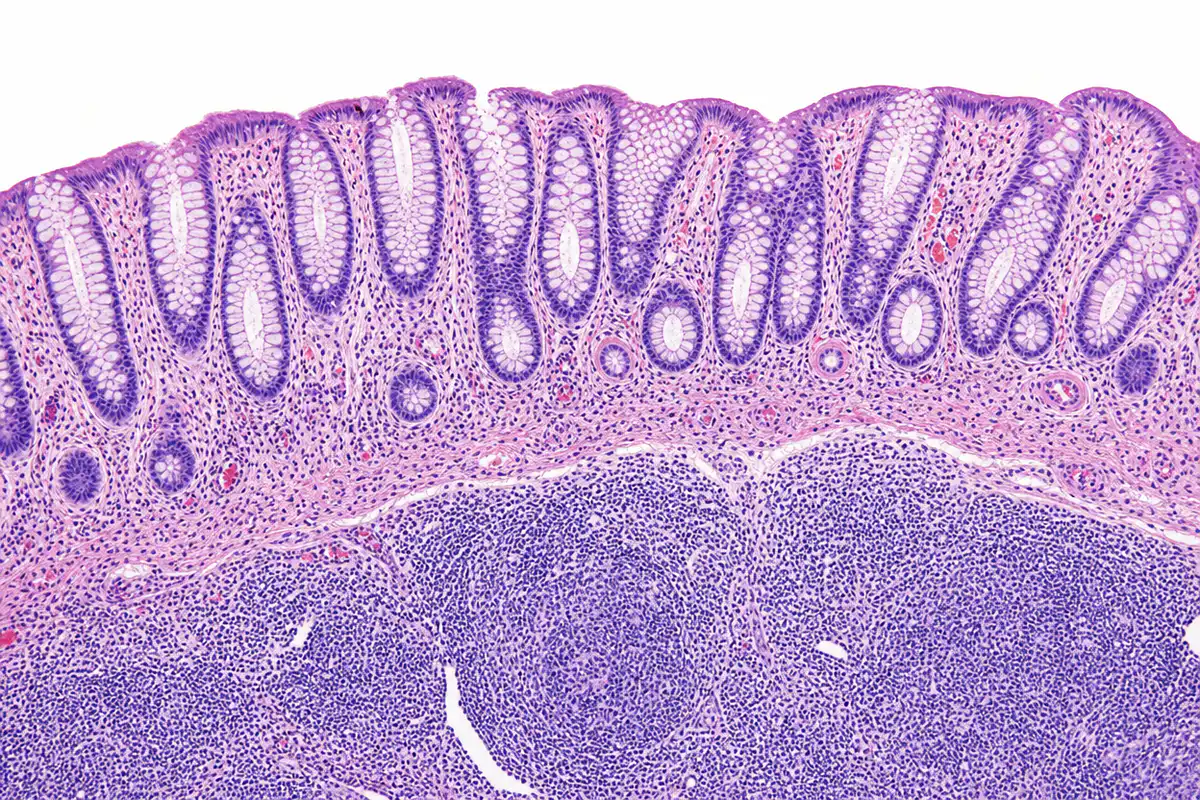 Processed blood vessel tissue section