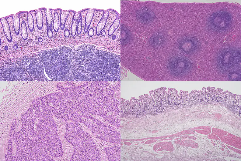 Microscopic field showing clear tissue structure