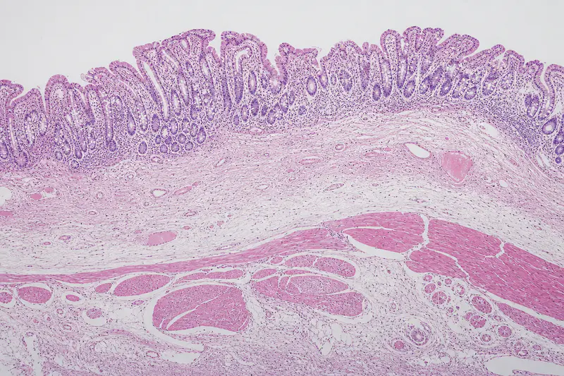 Processed tumor tissue section