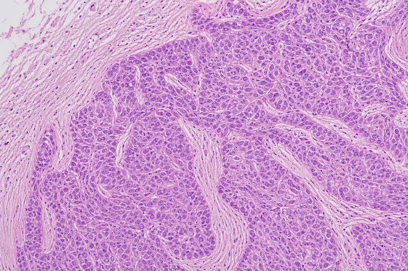 H&E stained cervical tissue slide