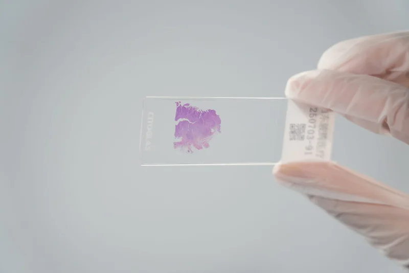 Technician checking finished coverslipped pathology slides before shipment